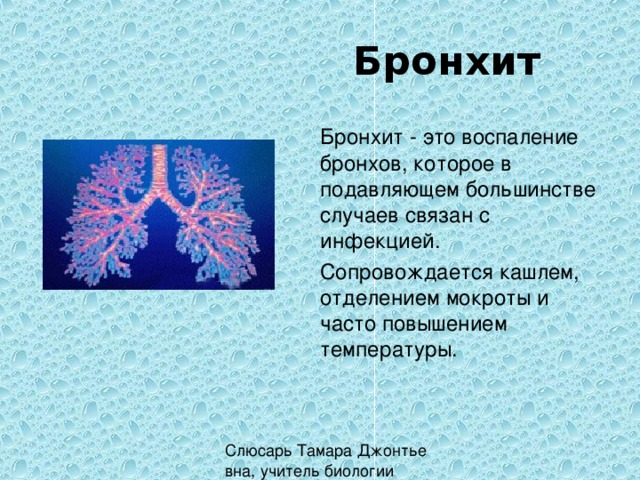 Бронхит Бронхит - это воспаление бронхов, которое в подавляющем большинстве случаев связан с инфекцией.  Сопровождается кашлем, отделением мокроты и часто повышением температуры. 