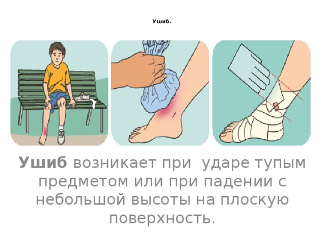 Как снять ушиб в домашних условиях Ушиб локтевого сустава: признаки травмы и её последствия