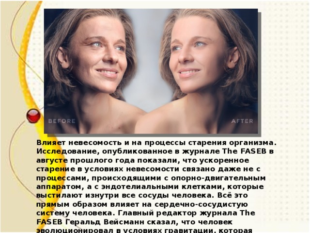 Влияет невесомость и на процессы старения организма. Исследование, опубликованное в журнале The FASEB в августе прошлого года показали, что ускоренное старение в условиях невесомости связано даже не с процессами, происходящими с опорно-двигательным аппаратом, а с эндотелиальными клетками, которые выстилают изнутри все сосуды человека. Всё это прямым образом влияет на сердечно-сосудистую систему человека. Главный редактор журнала The FASEB Геральд Вейсманн сказал, что человек эволюционировал в условиях гравитации, которая использовалась для регулирования биологических процессов. Без гравитации, подчеркнул Вайсманн, ткани теряются и быстро стареют.