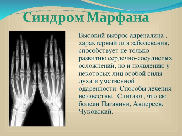 Высокий выброс адреналина , характерный для заболевания, способствует не только развитию сердечно-сосудистых осложнений, но и появлению у некоторых лиц особой силы духа и умственной одаренности. Способы лечения неизвестны. Считают, что ею болели Паганини, Андерсен, Чуковский. 