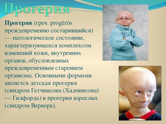 Прогерия (греч. progērōs преждевременно состарившийся) — патологическое состояние, характеризующееся комплексом изменений кожи, внутренних органов, обусловленных преждевременным старением организма. Основными формами является детская прогерия (синдром Гетчинсона (Хадчинсона) — Гилфорда) и прогерия взрослых (синдром Вернера). 