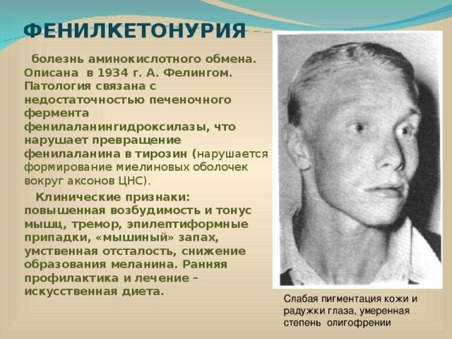 ФЕНИЛКЕТОНУРИЯ  болезнь аминокислотного обмена. Описана в 1934 г. А. Фелингом. Патология связана с недостаточностью печеночного фермента фенилаланингидроксилазы, что нарушает превращение фенилаланина в тирозин ( нарушается формирование миелиновых оболочек вокруг аксонов ЦНС).  Клинические признаки: повышенная возбудимость и тонус мышц, тремор, эпилептиформные припадки, «мышиный» запах, умственная отсталость, снижение образования меланина. Ранняя профилактика и лечение – искусственная диета.  Слабая пигментация кожи и радужки глаза, умеренная степень олигофрении 