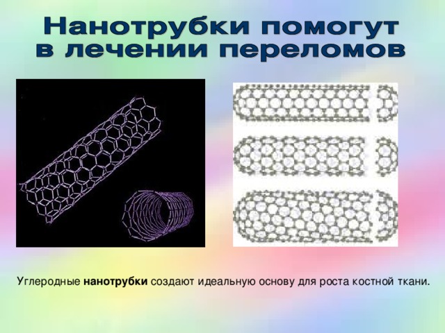 Углеродные нанотрубки создают идеальную основу для роста костной ткани. 