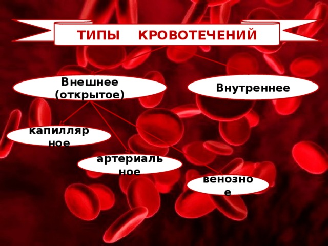 ТИПЫ КРОВОТЕЧЕНИЙ Внутреннее Внешнее (открытое) капиллярное артериальное венозное 