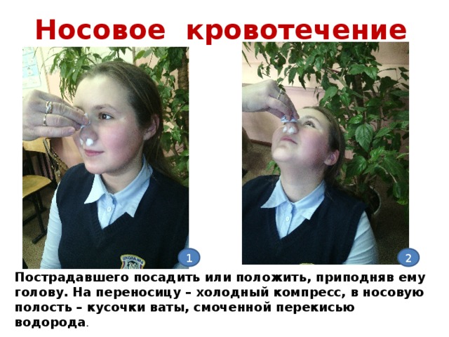 перекись при кровотечении. перекись водорода обладает кровоостанавливающим действием. первая помощь обработка раны. перекись водорода при кровотечение из носа. применение пероксида водорода.