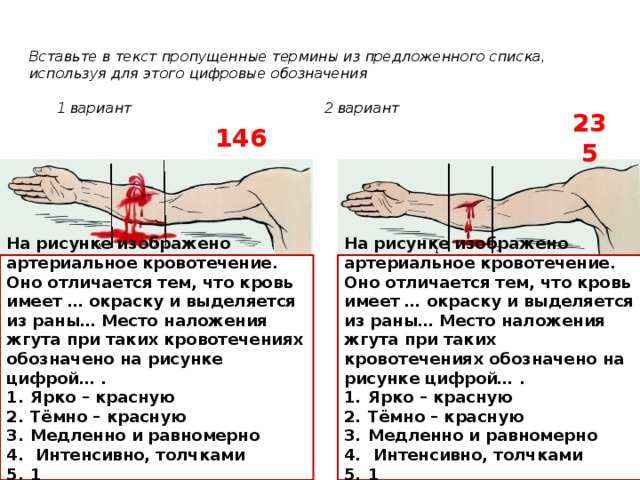 Рассмотрите рисунки 1 3 на которых изображены виды наружного кровотечения у человека