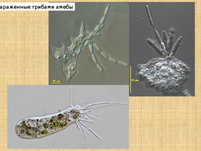 Зараженные грибами амебы 