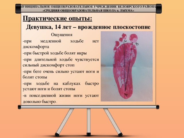 болят икры при ходьбе. икры ног. болят икры при ходьбе. синдром бегуна колено илиотибиального тракта. болболь в икроножной мышце.