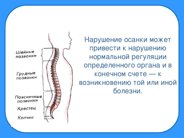 Нарушение осанки может привести к нарушению нормальной регуляции определенного органа и в конечном счете — к возникновению той или иной болезни.