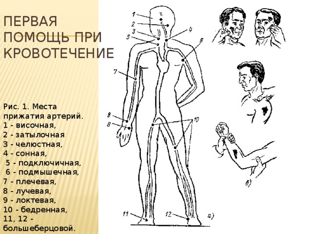 Первая помощь при кровотечение Рис. 1. Места прижатия артерий. 1 - височная, 2 - затылочная 3 - челюстная, 4 - сонная,  5 - подключичная,  6 - подмышечная, 7 - плечевая, 8 - лучевая, 9 - локтевая, 10 - бедренная, 11, 12 - большеберцовой. 